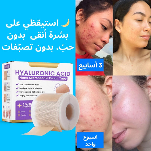 💖 شريط LayaliCare لإصلاح البشرة وتجديدها بعمق من التهيّجات وحب الشباب